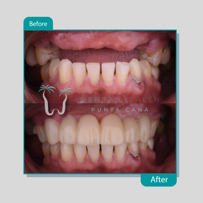 Dental Helath(220)