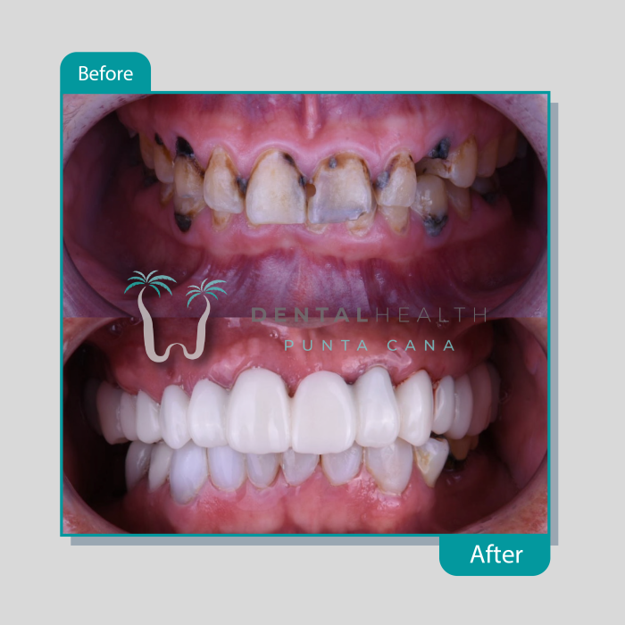 Dental Helath(224)
