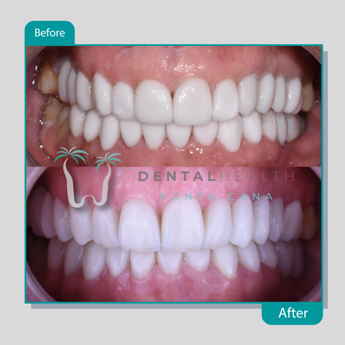Dental Helath(227)