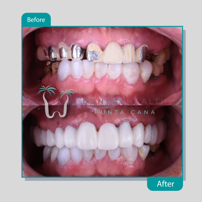Dental Helath(230)