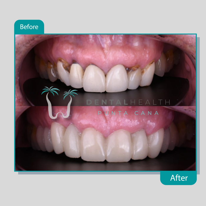Dental Helath(236)