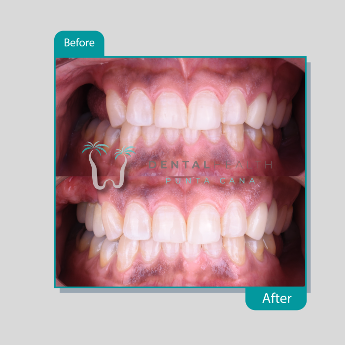 Dental Helath(239)