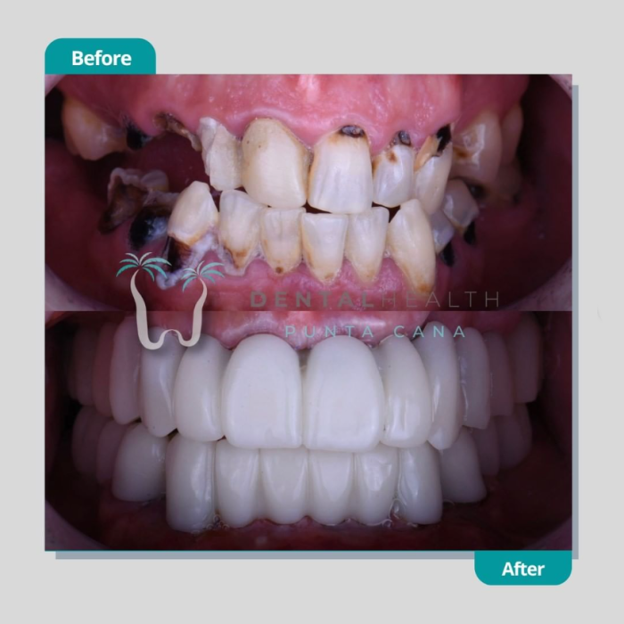 Dental Helath(259)