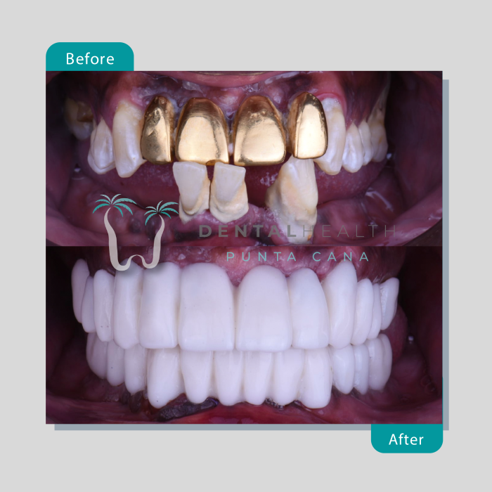 Dental Helath(260)