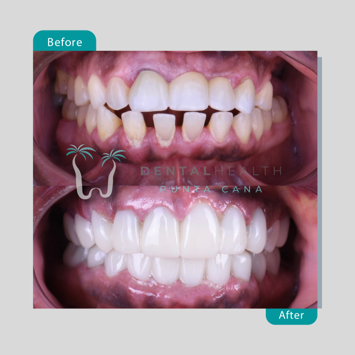 Dental Helath(264)