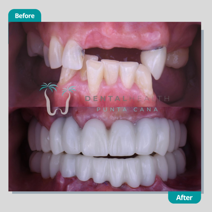 Dental Helath(265)