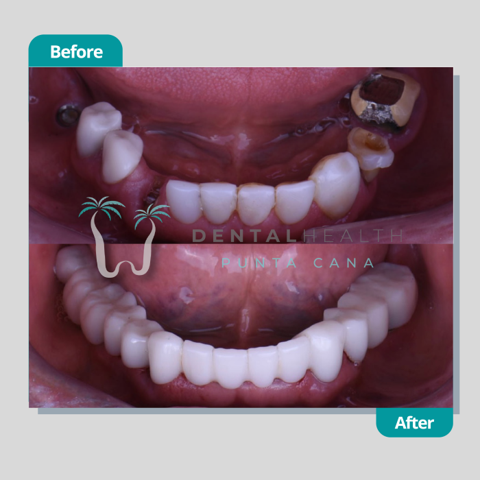 Dental Helath(267)