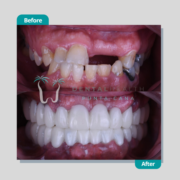 Dental Helath(267)