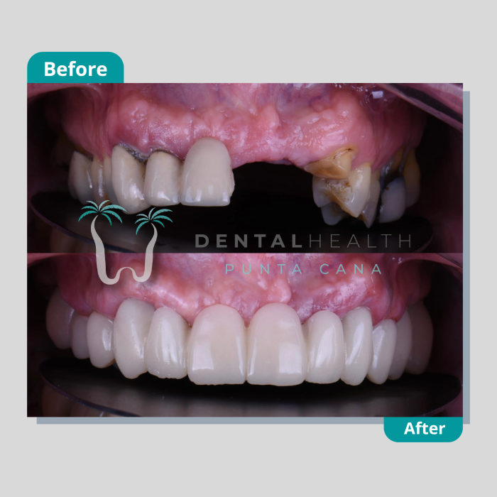 Dental Helath(268)