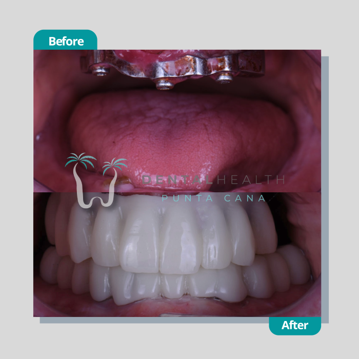 Dental Helath(270)